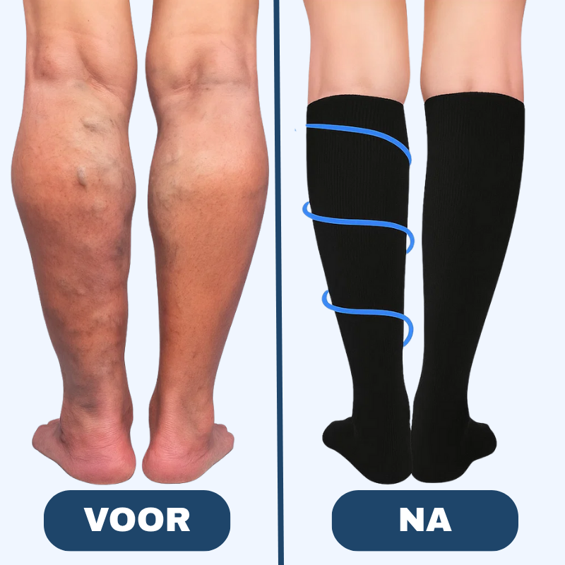 VitaalStep™ Compressiekousen
