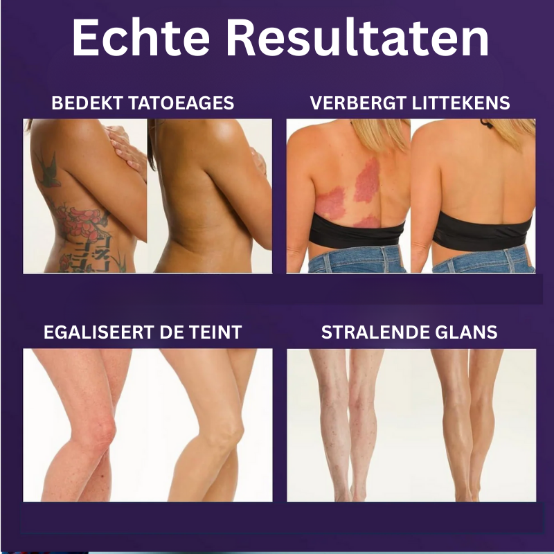 Nudaskin™ Huidperfecter