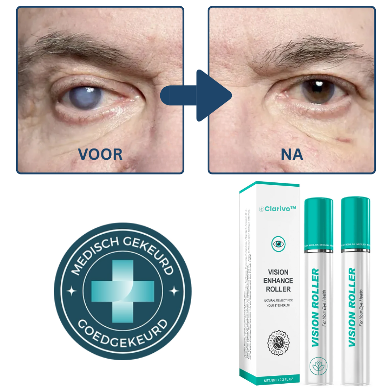 Clarivo™ OogLift Roller | Herontdek een helder & comfortabel zicht in slechts 5 minuten