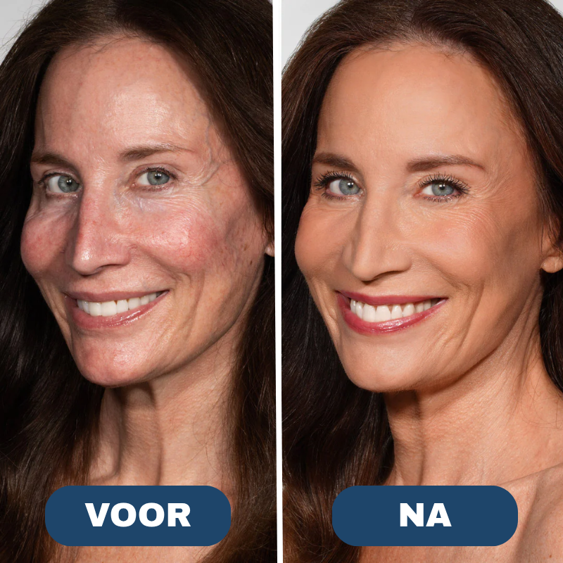 Serova™ Adaptieve Tintcrème