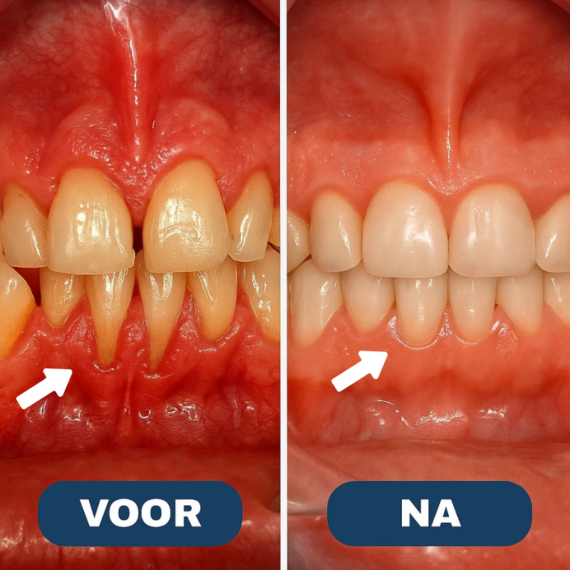 VitaGum™ Herstelgel