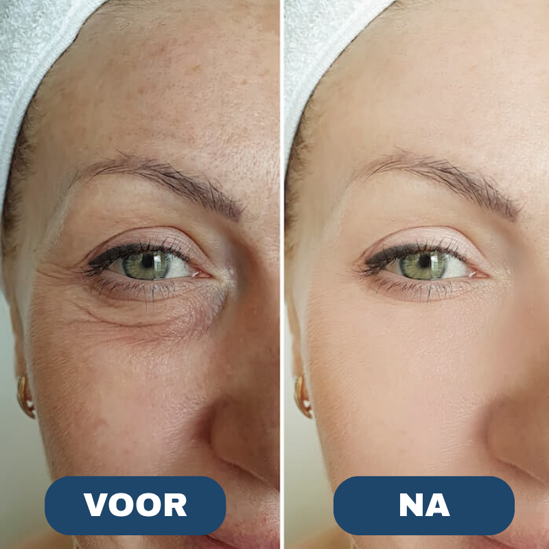 Velisse™Lifting Oogcrème